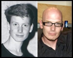 Robbie's Story
